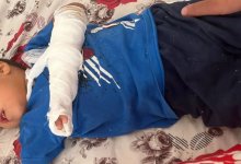 Мальчику раздавило палец в детском саду Мангистау