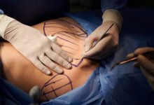 Врачи спасли жизнь итальянцу в Абайской области