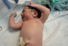 Врач приняла роды у обезглавленной женщины в секторе Газа