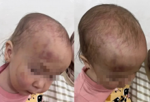 Мать избитой девочки из Актау обвинила следствие в попытке замять дело