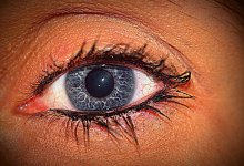 Отек после наращивания ресниц появился у жительницы Актау