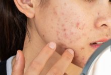 Казахстанка пострадала от косметики, разрекламированной блогером