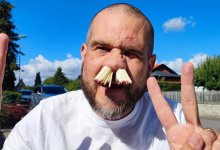 Житель Швеции засунул в ноздри 81 спичку ради детей