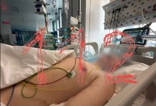 Избивали и мучили воспитатели: над детьми жестоко издевались в России