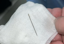 Младенцу извлекли иглу из печени в Туркестане