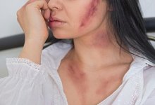 Случайное знакомство в парке закончилось жестоким избиением и тюрьмой в Актобе