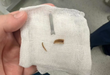 Железка месяцами скрывалась в легких ребенка из Мангистау