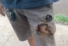 Взорвавшийся телефон спас мужчину от агрессивных собак