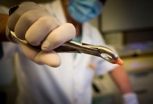 В носу подростка вырос зуб