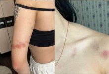 Хоккеист избил девушку в Кокшетау: новые подробности