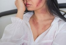 Женщину жестоко избили лопатой и сломали руки в Алматинской области