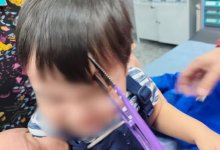 Мальчик пробил лоб ножницами при падении в Алматы