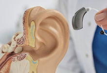 Свыше 500 детей получили бесплатные слуховые импланты в Казахстане