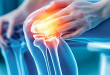 Почему щелкают колени и пальцы, и когда пора к врачу