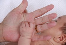 Мальчик с четырьмя ногами родился в Узбекистане
