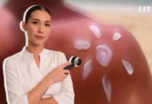 Как казахстанцам защитить кожу от солнца: советы дерматолога