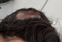 Лед рассек голову женщине с коляской в Павлодаре