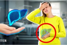 Как не пропустить заболевание печени: врач назвала важные симптомы