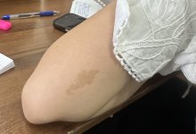 "Казахстан на коже": родимое пятно девушки удивило пользователей Threads