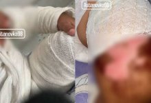 Полуторагодовалый ребенок получил ожоги III степени в детском саду Астаны
