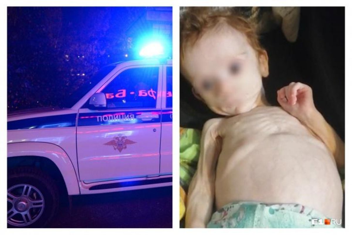 Прожившего полгода в шкафу младенца привезли в больницу на вертолете