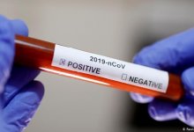 В Минздраве РК объяснили, кому можно пройти платные тесты на COVID-19 в НЦЭ