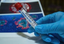 Сроки окончания пандемии коронавируса озвучил представитель ВОЗ