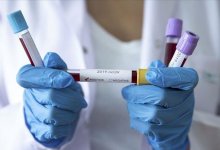 COVID-19 в Казахстане: уменьшилось количество зараженных за сутки