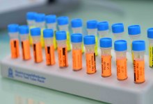 627 новых случаев коронавируса выявили за сутки в Казахстане