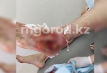 В ЗКО из-за укуса змеи у пастуха начались осложнения. Его прооперировали
