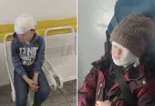 "На всю жизнь остались со шрамами": двух детей покусала собака в ВКО