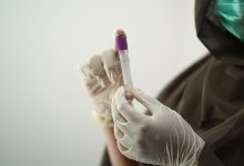 Заболеваемость сифилисом в США достигла максимума